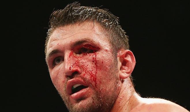 Hughie Fury Cut Kassi